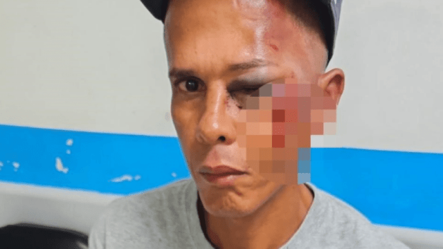 Hombre denuncia agresión por parte de empleados de transporte público en San Juan post thumbnail image