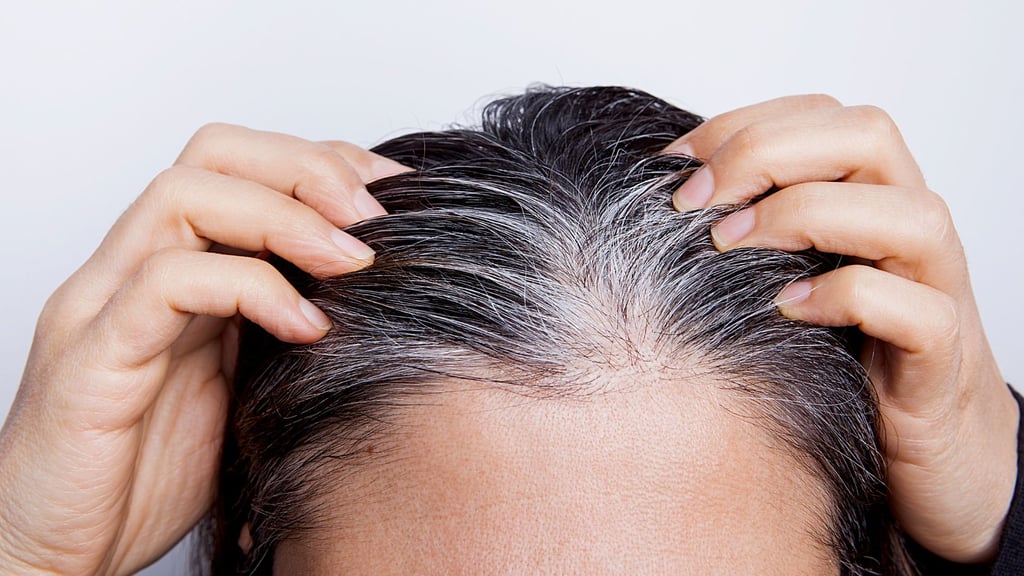 Alimentos que ayudan a evitar que crezcan las canas post thumbnail image